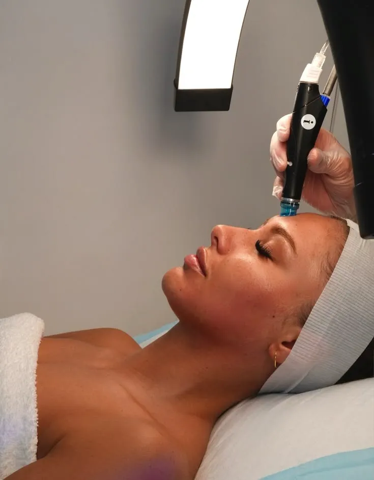Benefits of a HydraFacial